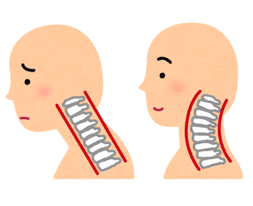 スマホが原因の頸、肩のこり